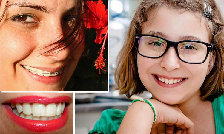 Estetică dentară