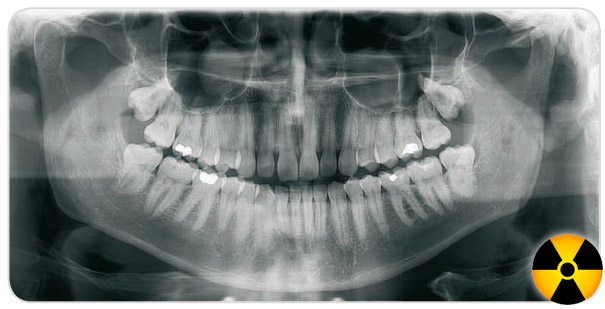radiologie-dentara